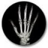 bonehand